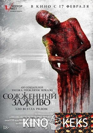 Сожженный заживо